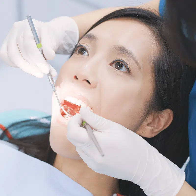 牙周病治療案例