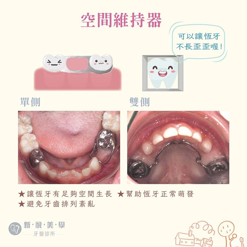 兒童蛀牙怎麼辦？家長必看完整指南