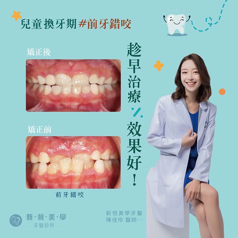 前牙錯咬與戽斗兒童早期矯正全攻略