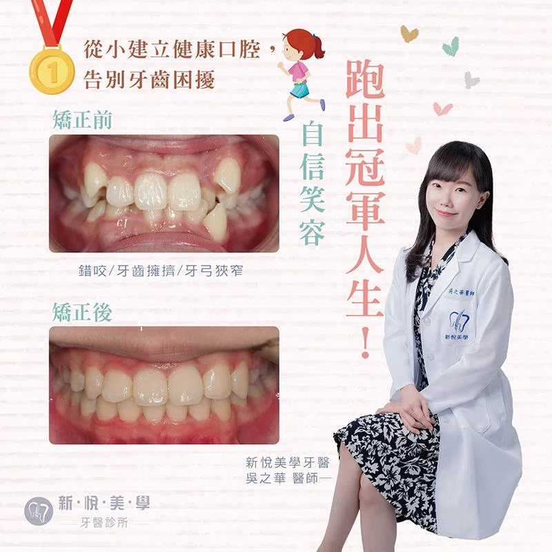 小學田徑明星的煩惱，從牙齒困擾到自信笑容