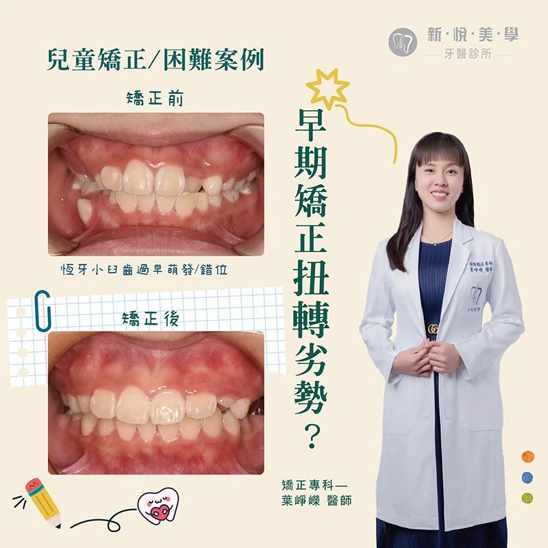 小佑的牙齒成長挑戰：早期矯正如何扭轉劣勢？