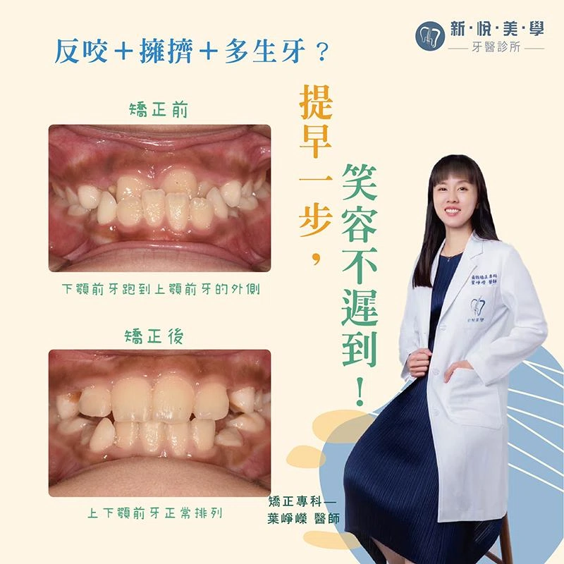 孩子的第一場矯正旅程，就從這顆多生牙開始！