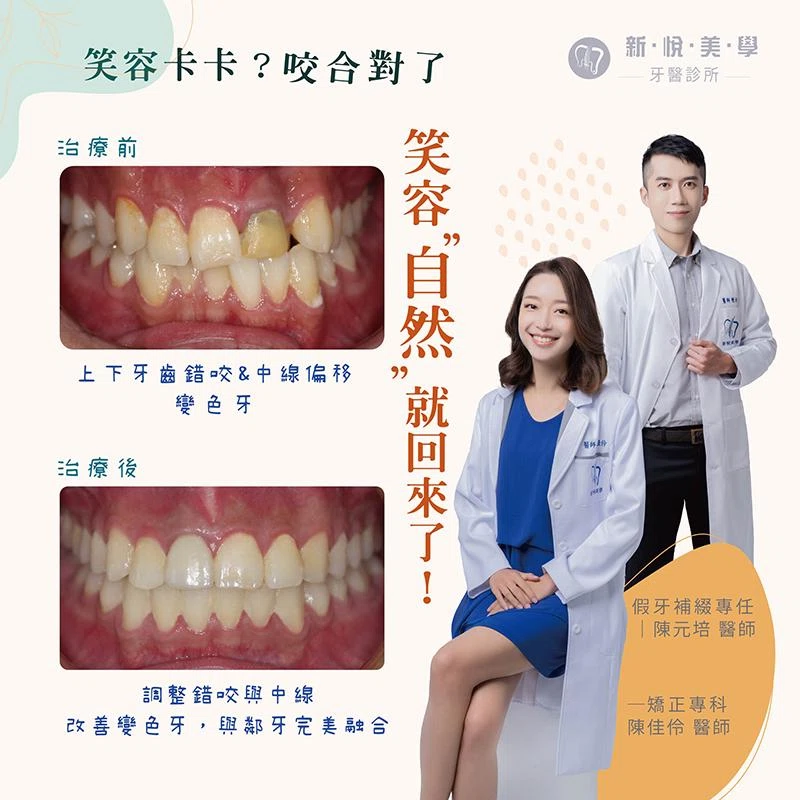 笑容卡卡？矯正＋全瓷冠，牙齒到位笑容回來！