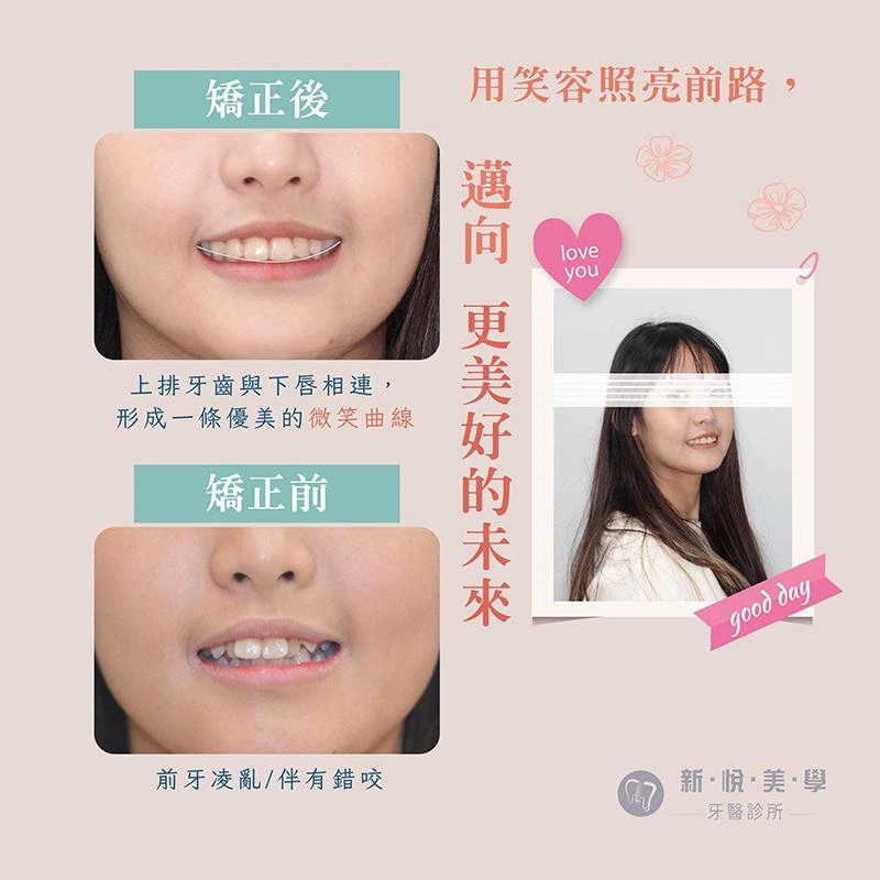 笑顏滿分的療癒系女孩茜茜|用笑容照亮未來 笑顏滿分的療癒系女孩茜茜|用笑容照亮未來