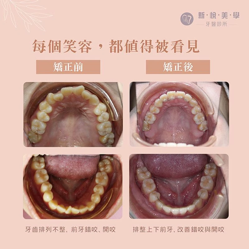 不是想變成誰,只是想更喜歡自己 不是想變成誰,只是想更喜歡自己