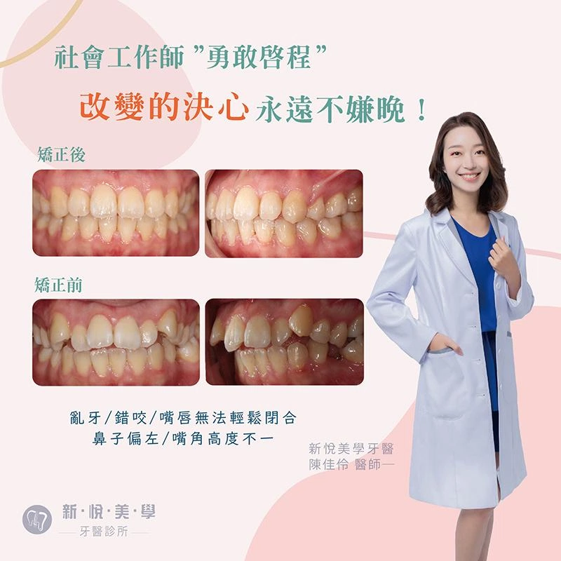 勇敢啟程：社工師的牙齒矯正，改變的決心永遠嫌不晚