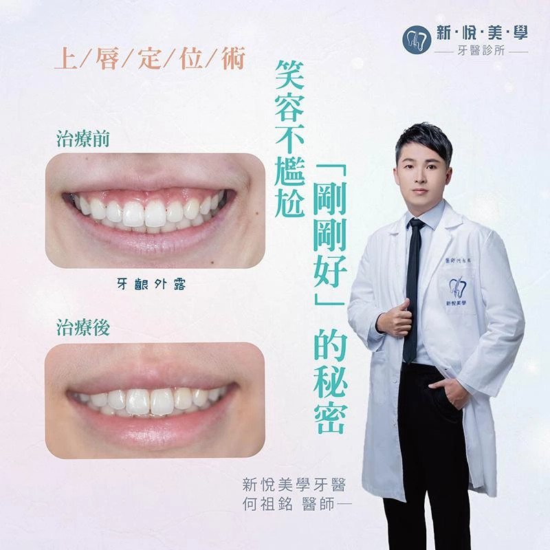 拍照不怕尷尬，笑容「剛剛好」的秘密