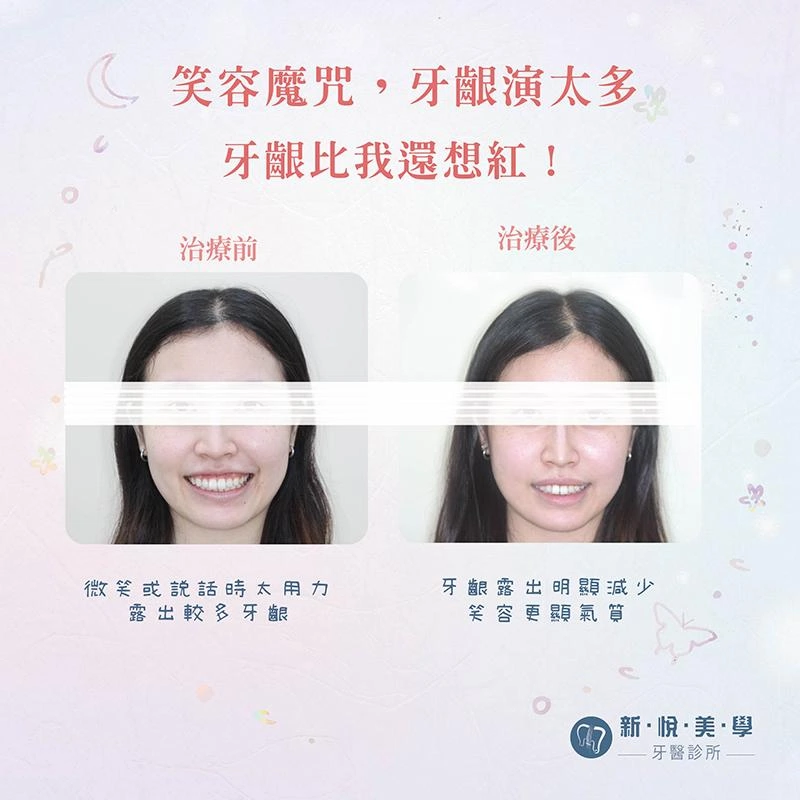 拍照不怕尷尬，笑容「剛剛好」的秘密