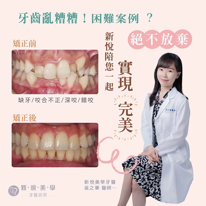 複雜牙齒問題？困難案例新悅陪妳實現"完美"