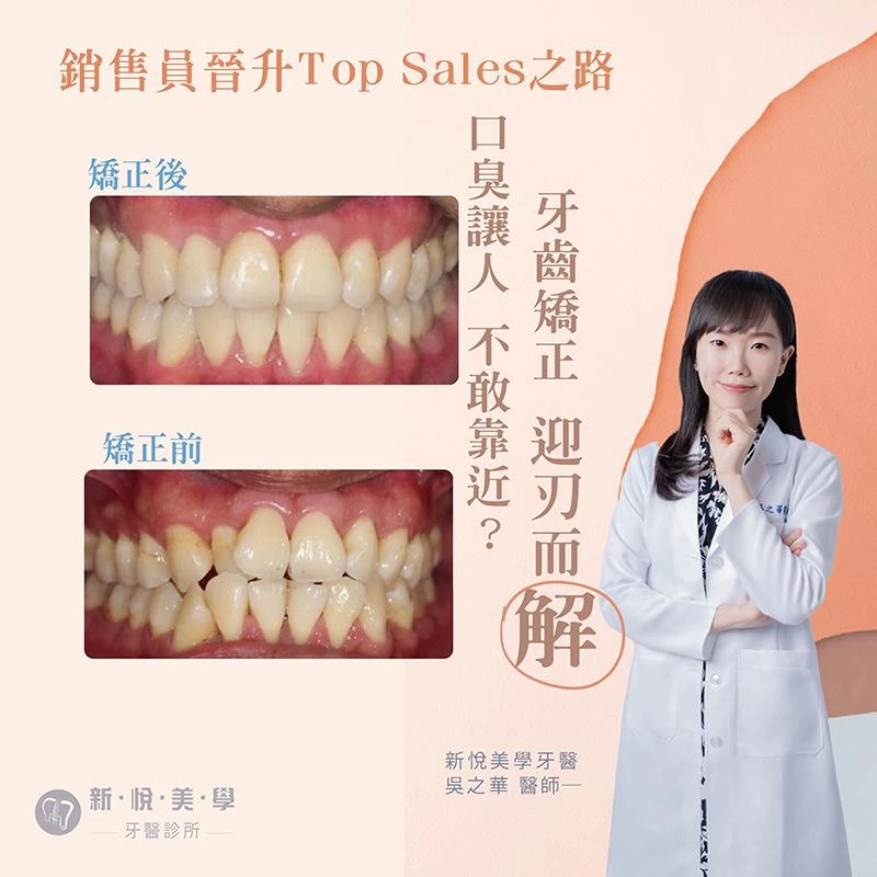 從口臭困擾到業績翻倍的成功轉變