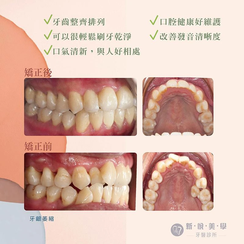從口臭困擾到業績翻倍的成功轉變 從口臭困擾到業績翻倍的成功轉變