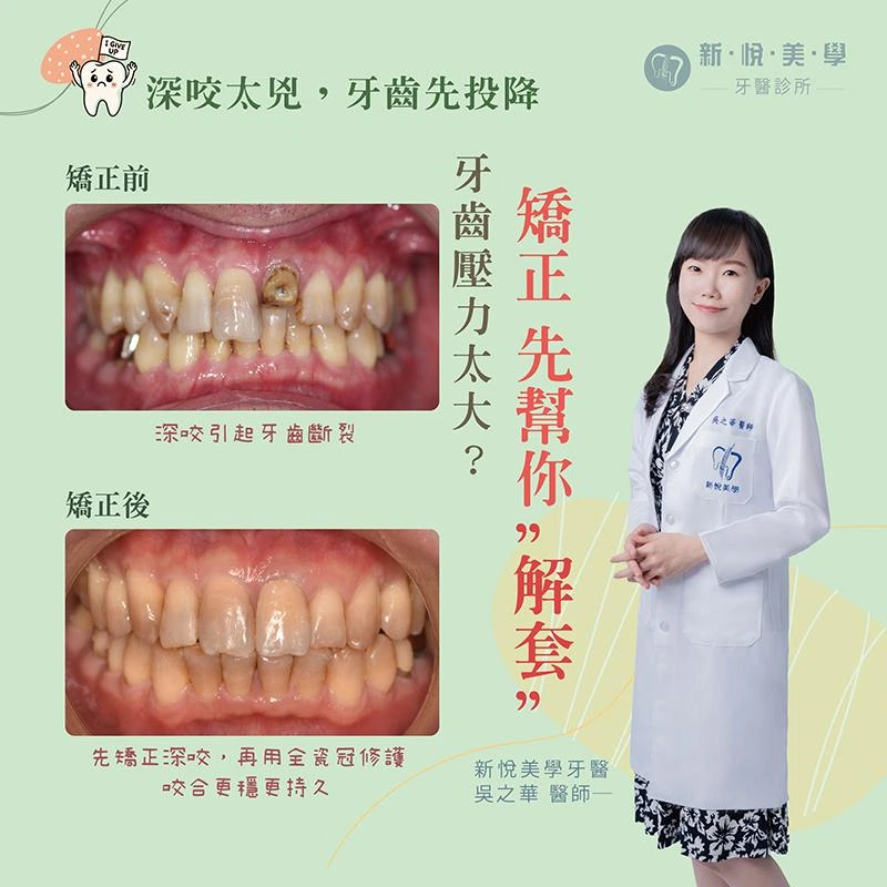 牙齒要耐用，關鍵不只是假牙，而是咬合