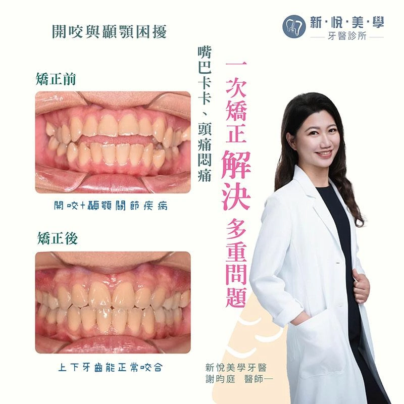 咬筆、吃軟糖竟造成顳顎關節疼痛？