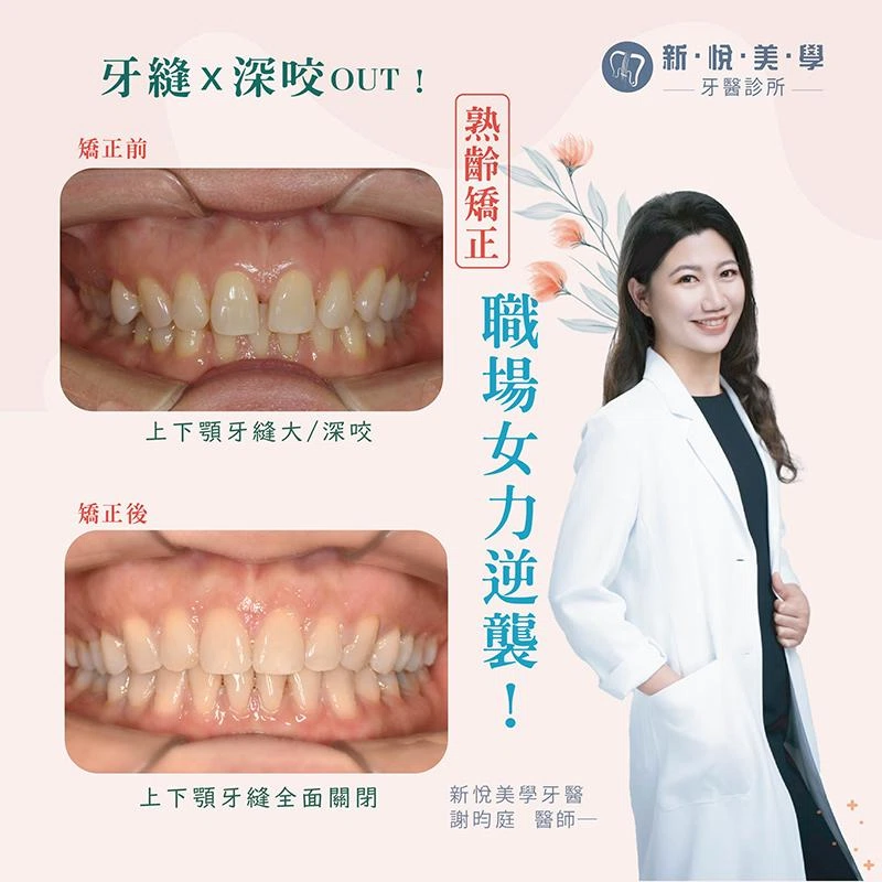 咬合穩了，笑容就穩了，就是職場的力量