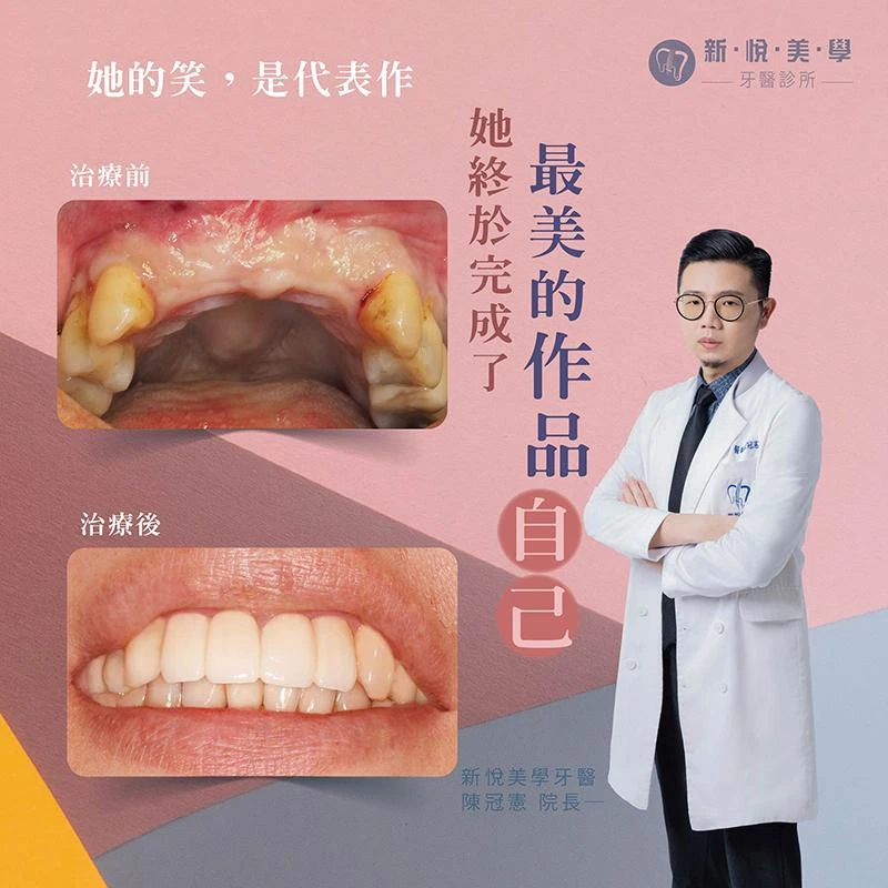 40歲後,她終於敢好好笑了 40歲後,她終於敢好好笑了