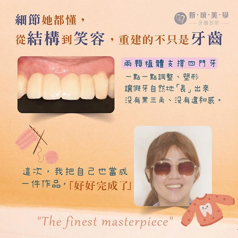 40歲後,她終於敢好好笑了 40歲後,她終於敢好好笑了