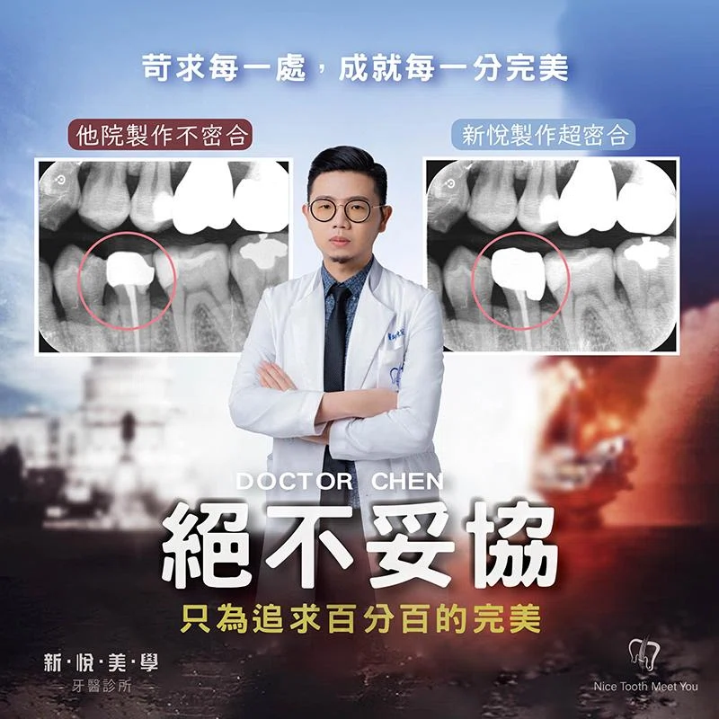 縫隙再小 絕不妥協，細節至上，只為成就百分百的完美笑容