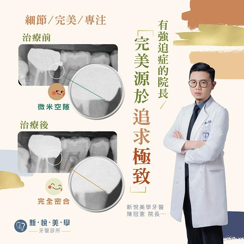 差一咪咪，肉眼看不出的縫隙都不放過 完美源於對細節的苛求