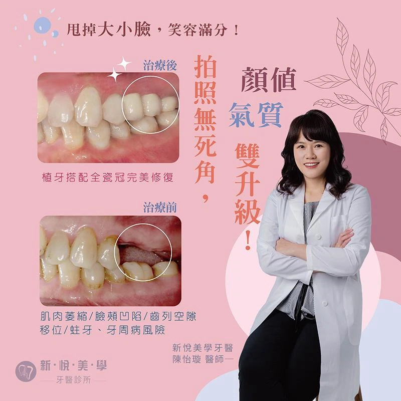 甩掉大小臉，笑容滿分！拍照無死角！顏值氣質雙升級！