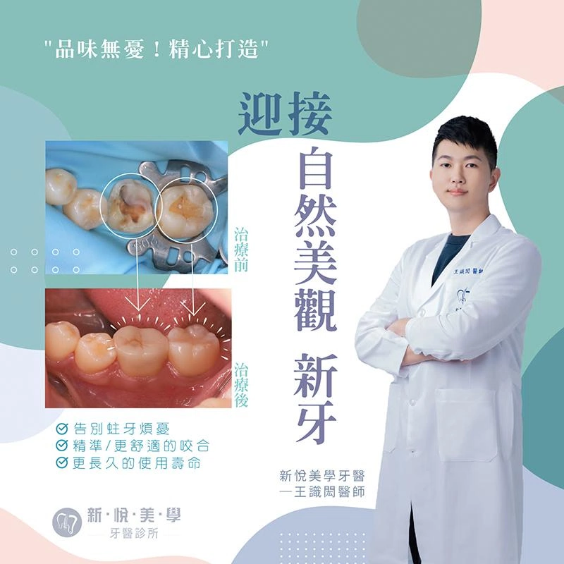 品味無憂 3D齒雕重建健康笑容