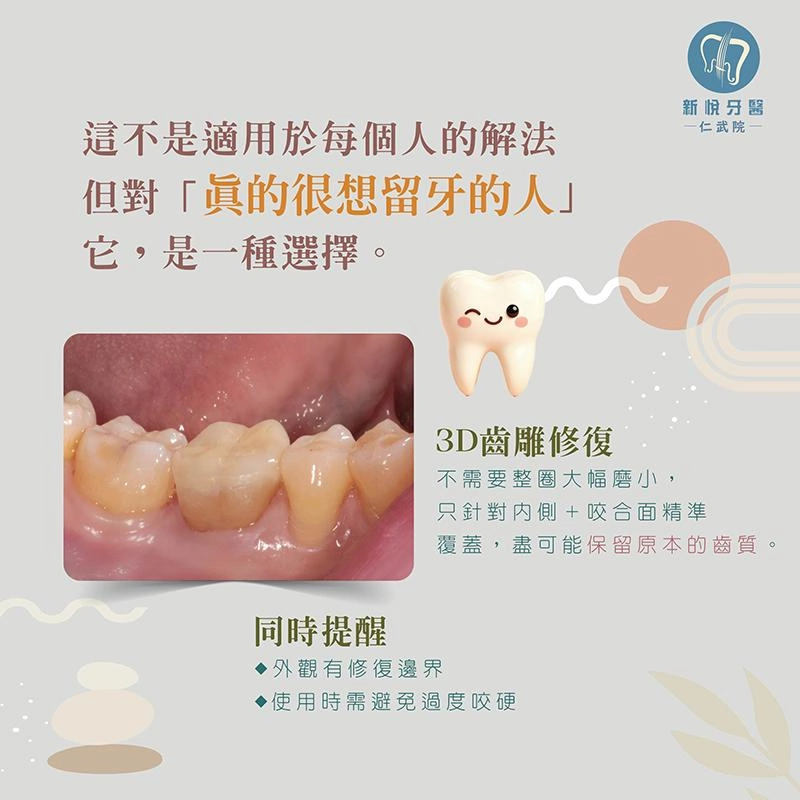 根管治療牙裂後還能留住嗎？3D齒雕修復的另一種選擇