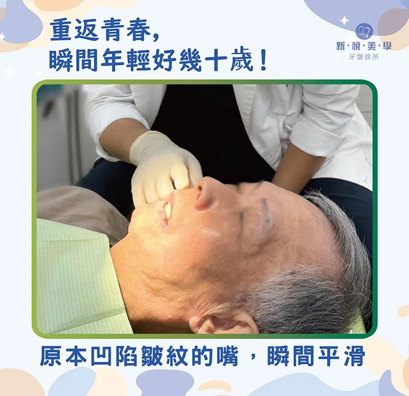 陳伯伯80歲重拾美食人生:植牙讓他笑得更年輕! 陳伯伯80歲重拾美食人生:植牙讓他笑得更年輕!