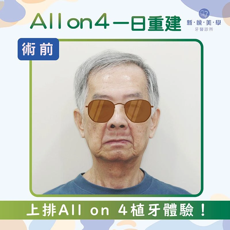 陳伯伯80歲重拾美食人生:植牙讓他笑得更年輕! 陳伯伯80歲重拾美食人生:植牙讓他笑得更年輕!