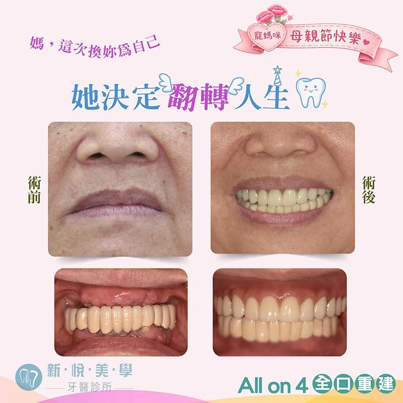 60歲那年，她終於把「將就的人生」還回去