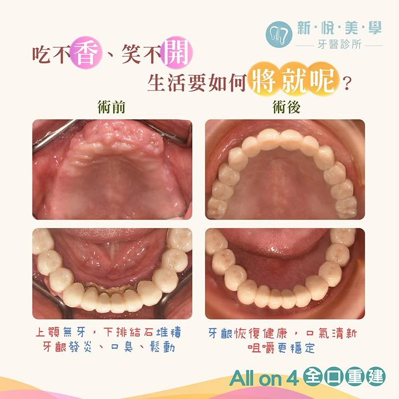 60歲那年，她終於把「將就的人生」還回去