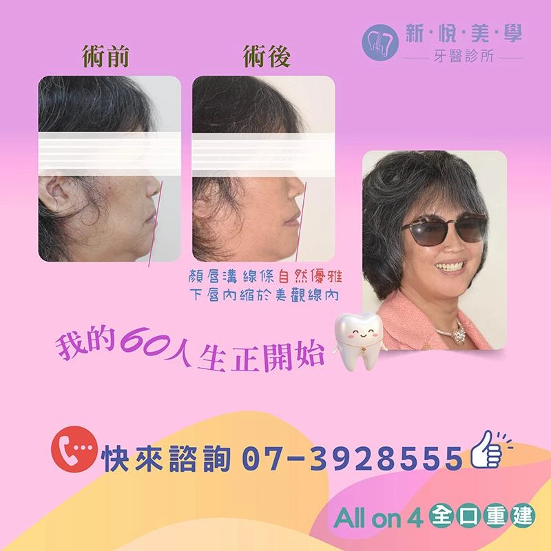 60歲那年，她終於把「將就的人生」還回去