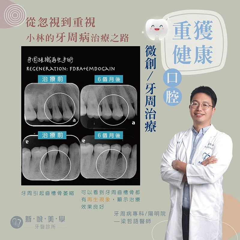 宅配司機小林的牙齦危機：微創牙周治療讓他重拾清新口氣與健康笑容