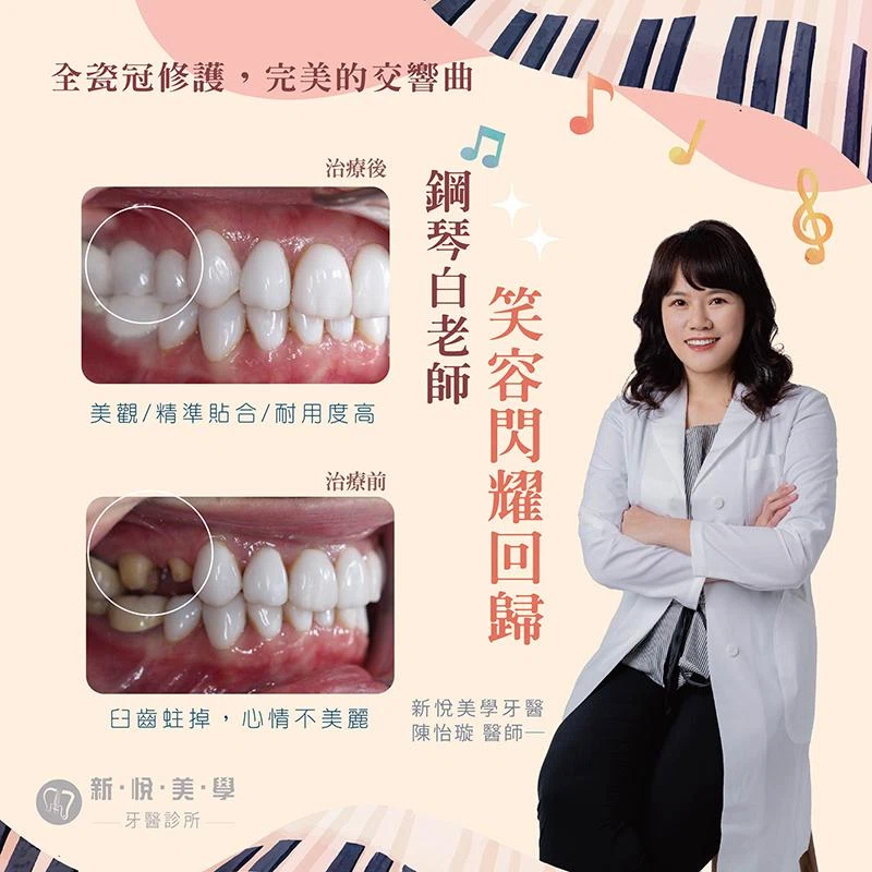 鋼琴白老師，閃耀笑容回歸