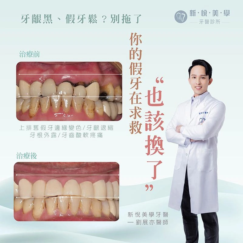 假牙戴久了，真的都沒問題嗎？