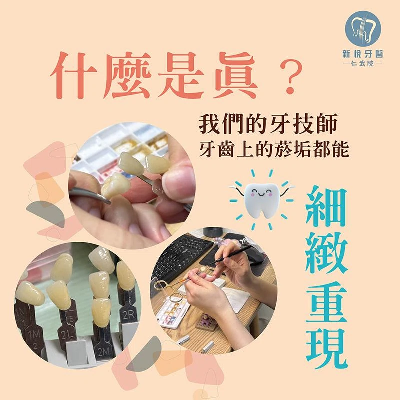 什麼是真？ 我們的牙技師，連你牙齒上的菸垢都能細緻重現喔！