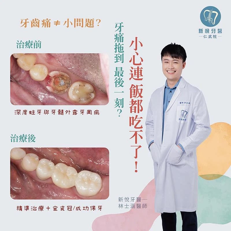 牙痛拖太久,差點只能拔牙? 牙痛拖太久,差點只能拔牙?