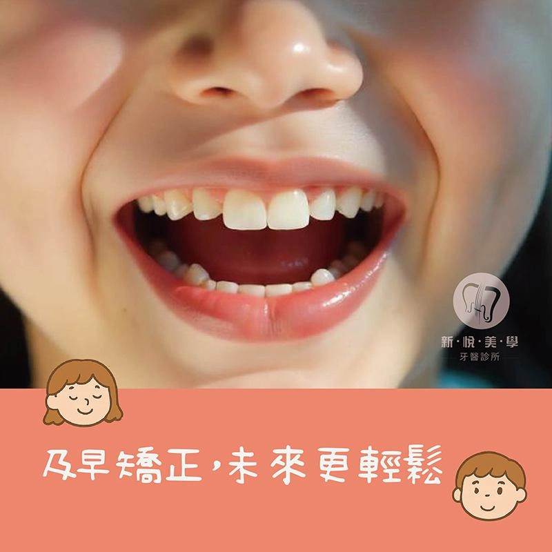 什麼是斜咬板？兒童早期咬合矯正關鍵裝置解析