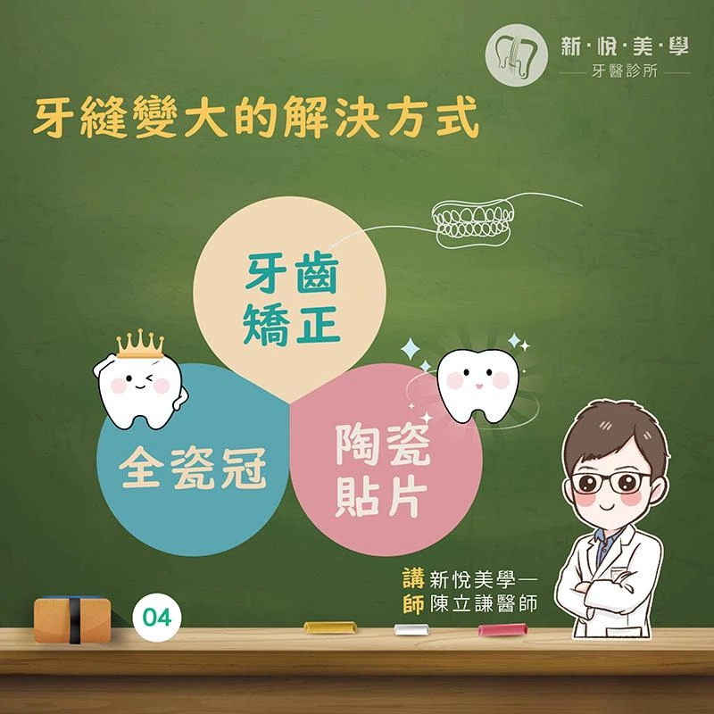 牙縫變大不是小事!其實可能是牙周病警訊! 牙縫變大不是小事!其實可能是牙周病警訊!
