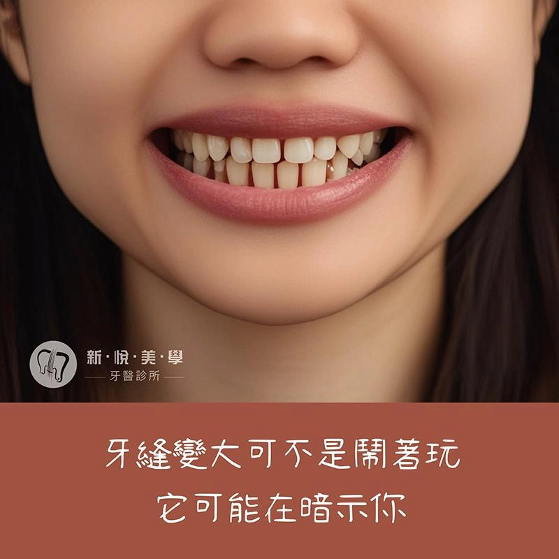 牙縫變大不是小事！其實可能是牙周病警訊！