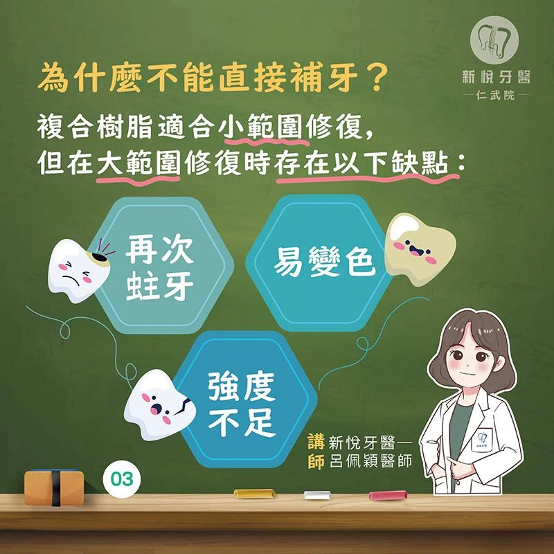 3D齒雕是什麼?為什麼比傳統補牙更好? 3D齒雕是什麼?為什麼比傳統補牙更好?