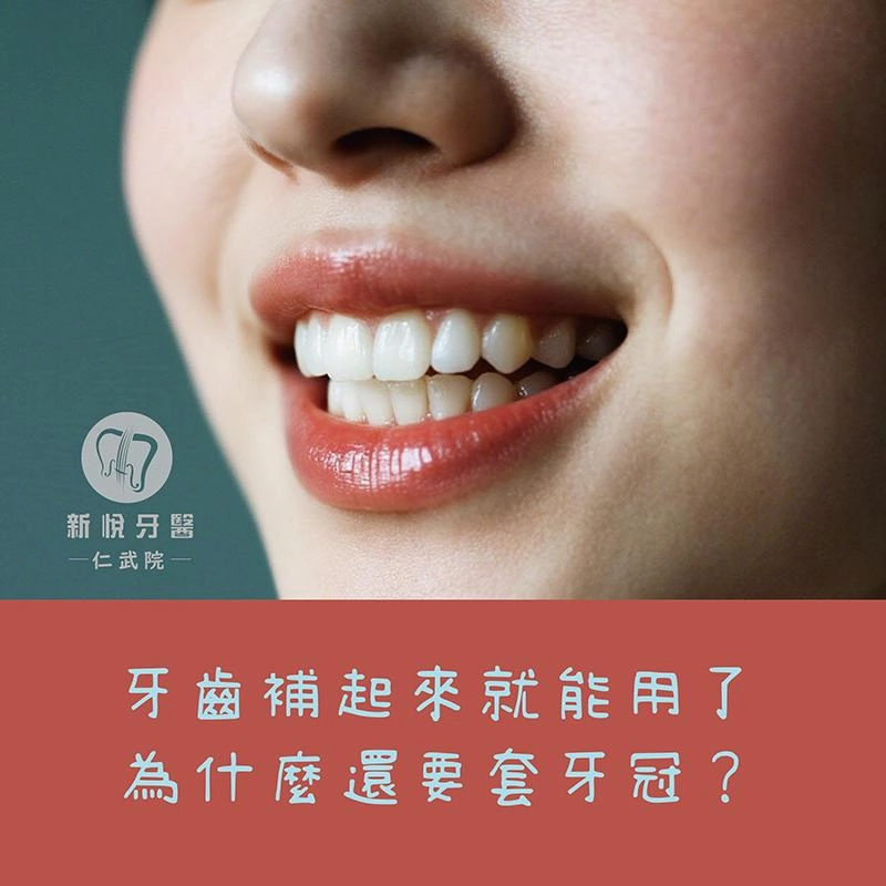 牙齒補起來就能用了，為什麼還要套假牙冠？