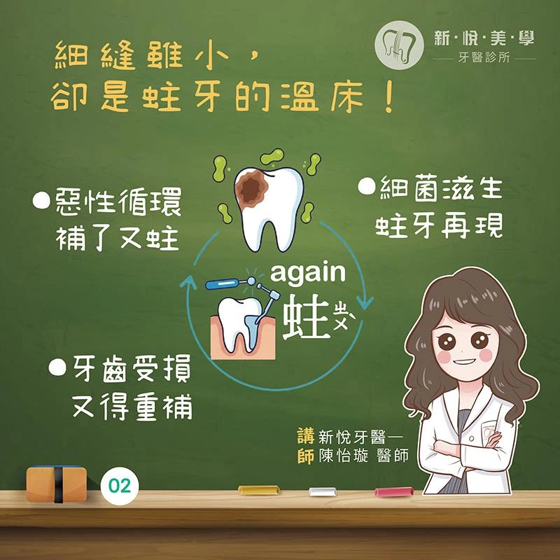 補了又蛀？3D微創齒雕說掰掰！