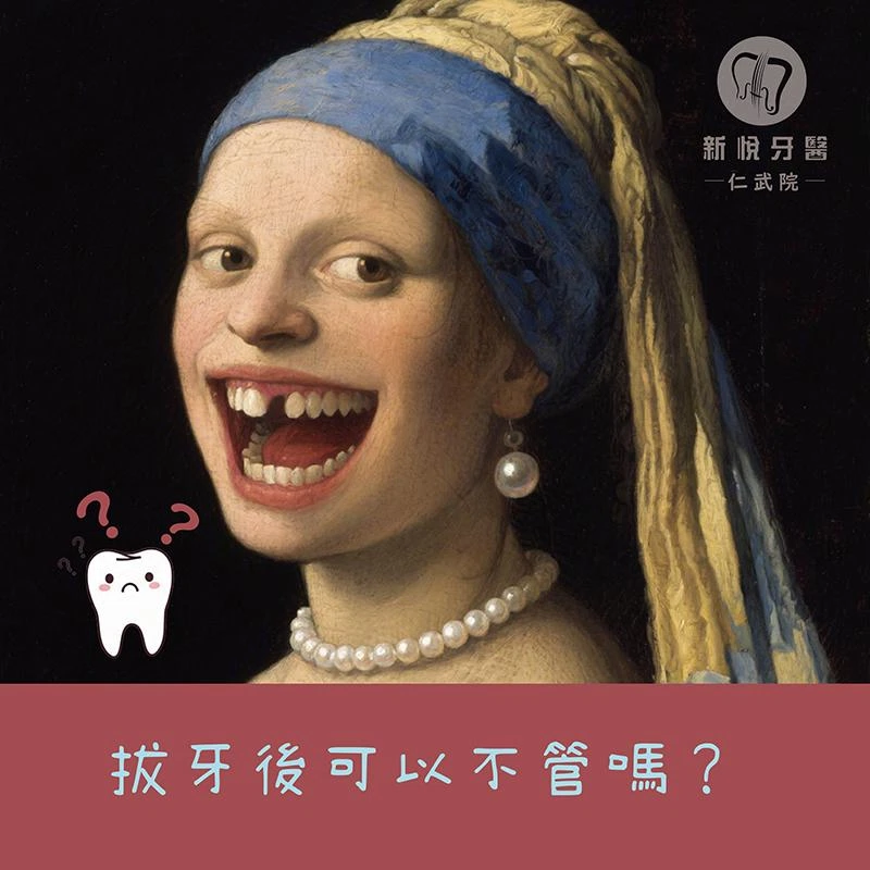 拔牙後不植牙會怎樣？骨頭流失的3大後果