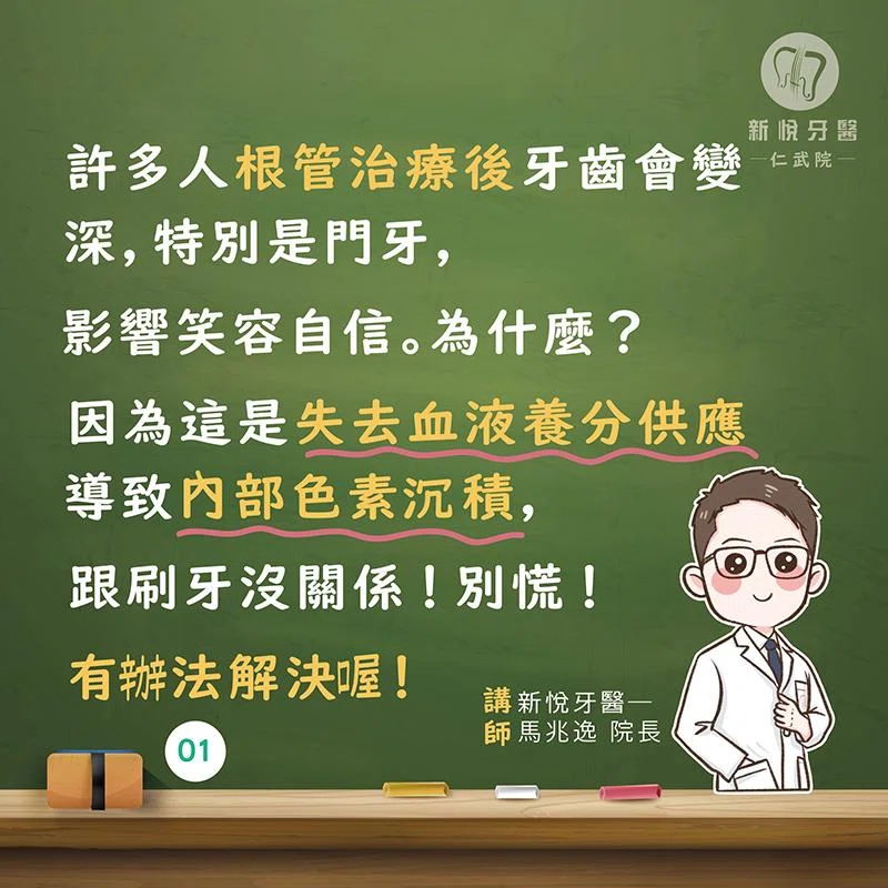 根管後笑不出來?3 招還你亮白牙! 根管後笑不出來?3 招還你亮白牙!