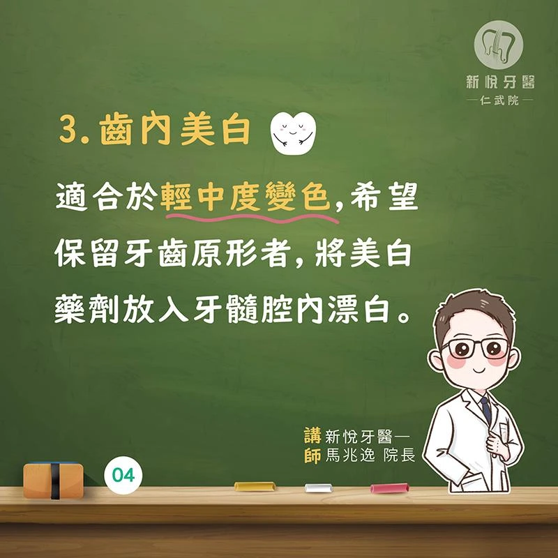 根管後笑不出來?3 招還你亮白牙! 根管後笑不出來?3 招還你亮白牙!