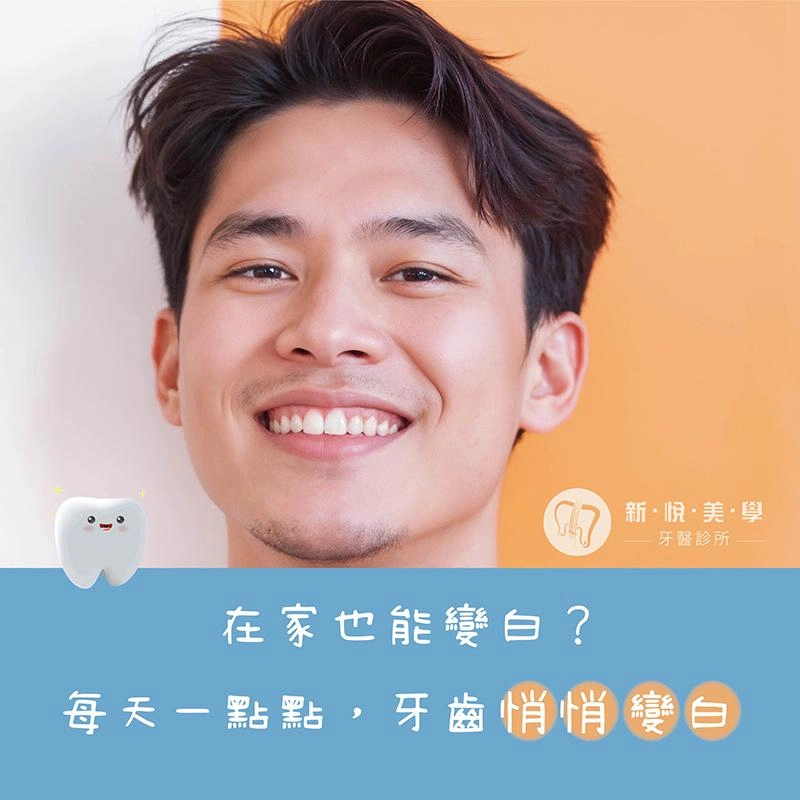 夏天笑容升級✨ 在家也能慢慢白回來! 夏天笑容升級✨ 在家也能慢慢白回來!