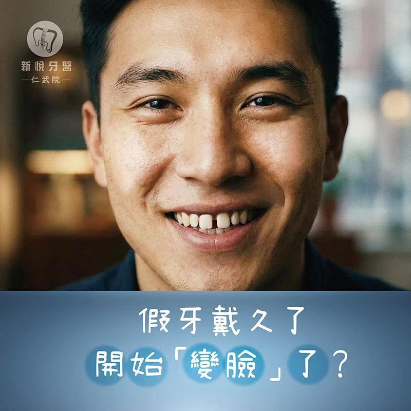 假牙黑邊怎麼來的?牙齦退縮是關鍵之一 假牙黑邊怎麼來的?牙齦退縮是關鍵之一