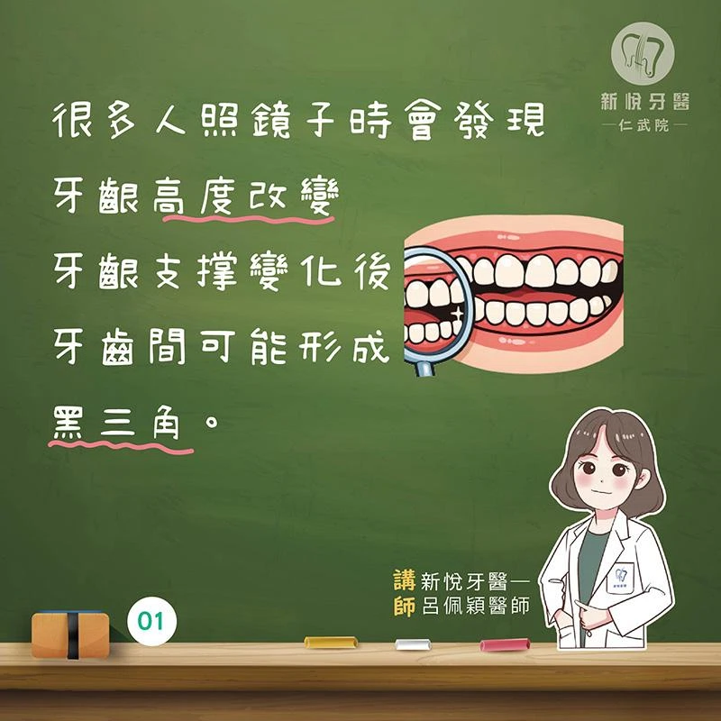 假牙黑邊怎麼來的?牙齦退縮是關鍵之一 假牙黑邊怎麼來的?牙齦退縮是關鍵之一