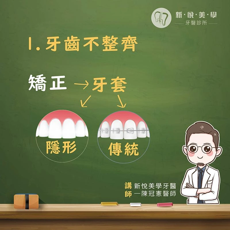 美女為何要戴口罩笑?6大齒科煩惱一次解決! 美女為何要戴口罩笑?6大齒科煩惱一次解決!