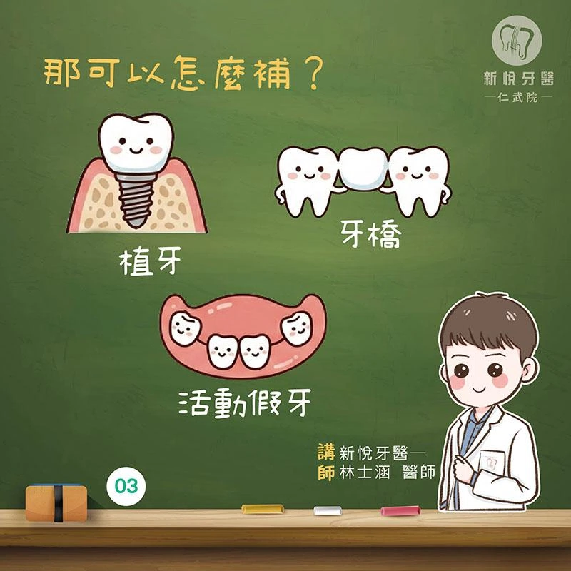 門牙缺失怎麼辦？缺牙對發音、咀嚼與笑容的影響一次看懂