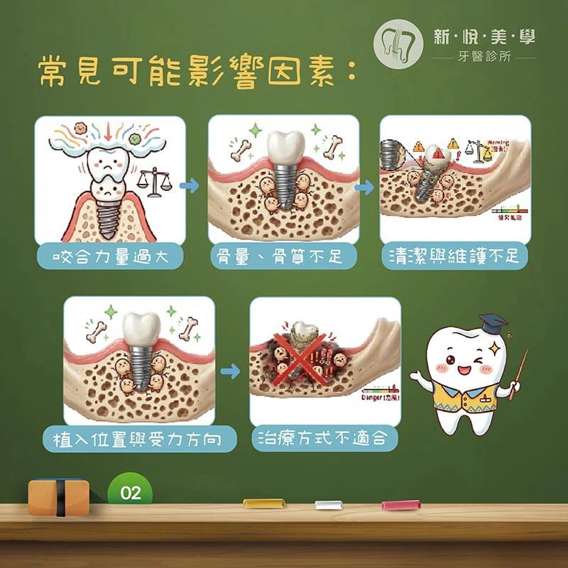 Mini Implant 為什麼會失敗？迷你植體適合長期植牙嗎？